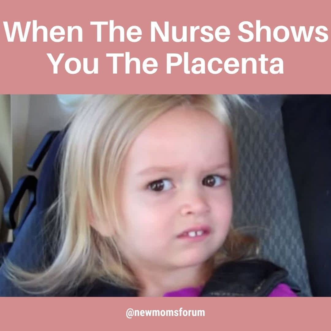 When The Nurse Shows You The Placenta - Pregnancy - 2021 When The Nurse Shows You The Placenta