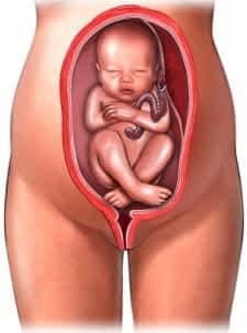complete breech