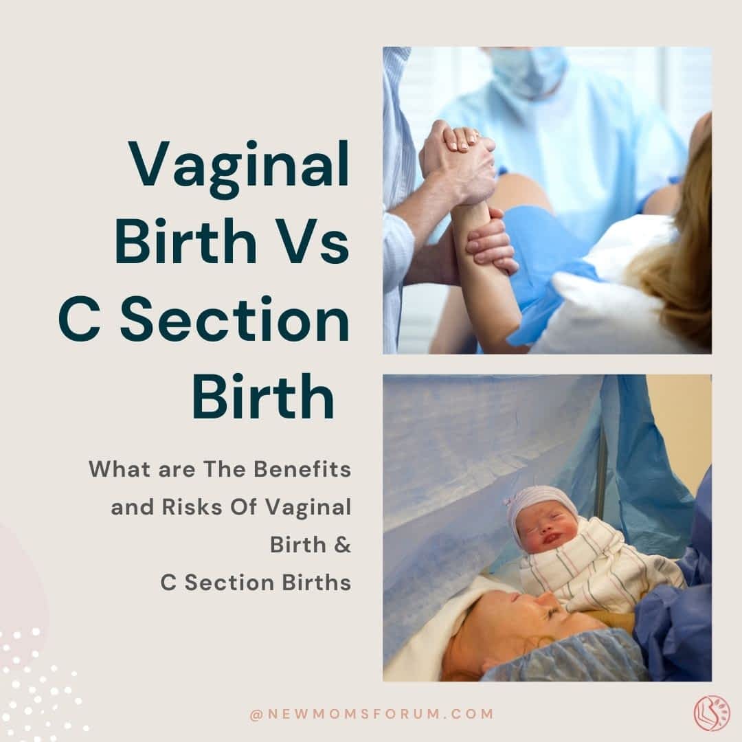 Vaginal Birth Vs C Section Birth - Which Is Better? - Delivery And Postpartum - 2021 Vaginal Birth Vs C Section Birth