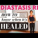 How To Know If Diastasis Recti Is Healed - Prenatal Workouts Videos - 2021 How To Know If Diastasis Recti Is Healed - Prenatal Workouts Videos - 2021