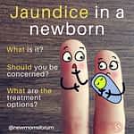 Jaundice In A Newborn - Delivery And Postpartum - 2021 Jaundice In A New Born
