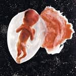18-Week-Old Fetus Enlarged Directly Into The Uterus - Pregnancy - 2021 This Is An 18-Week-Old Fetus Enlarged Directly Into The Uterus.
⠀
At This Time Of Gestation, We Can Already See Hands And Feet Formed With Little Fi...